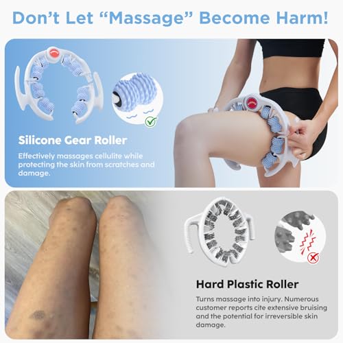 Cellulite Massage Tool - Lymphatic Drainage Massager - Muscle Roller, Deep Fascia Massage, Dimpled Skin Removal, Legs/Thighs/Buttocks, Anti-Cellulite Roller, Smooth Skin (14 Wheel - Blue) - color: White Blue