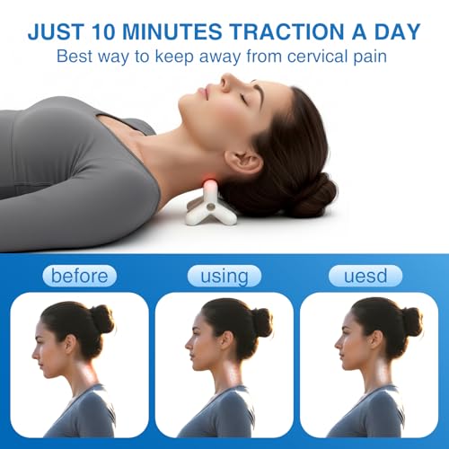 Occipital Release Tool, Release Tool for Neck for Headache Relief, Deep Nerve Release Tool with Acupressure Design Targeting Hard-to-Reach Muscles, Gift for Women & Men - color: White