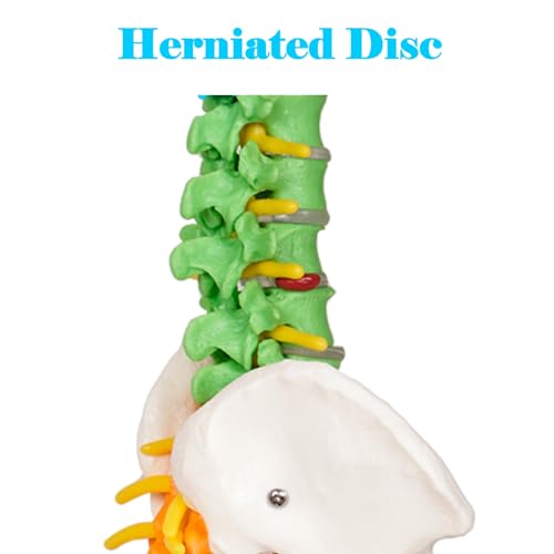 breesky Scientific Mini Spine Model, 15.5’’ Anatomical Spine Model with All Nerves, Human Anatomy Model with Stand for Instruction, Study and Display