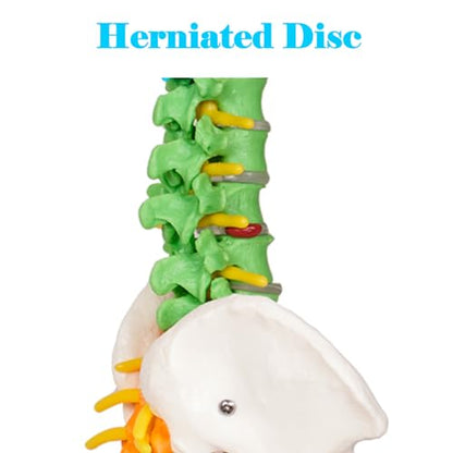breesky Scientific Mini Spine Model, 15.5’’ Anatomical Spine Model with All Nerves, Human Anatomy Model with Stand for Instruction, Study and Display