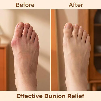 Pilates Toe Corrector with Yoga Ball, Premium Eco-Friendly Leather Toe Gizmo for Foot Pilates & Bunion Relief, Big Toe Alignment Stretcher Exercise Band for Women Men, Brown