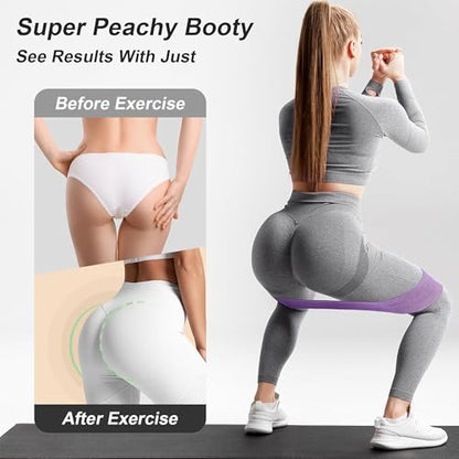 FitTrendz Resistance Bands for Legs and Butt Exercise Bands, Non Slip Elastic Fabric Bands 3 Levels Loop Workout Bands for Women Squat Glute Hip Training, Set of 3 Pack