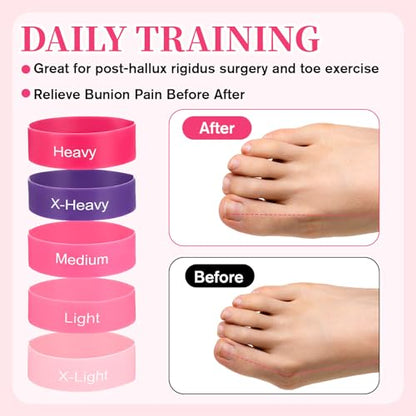 TIESOME 5 PCS Toe Bands Big Toe Spacers for Bunion Correction, Toe Stretcher Bands Toe Spacers Resistance Straightener Loop Band with Storage Bag for Women Men(Pink)