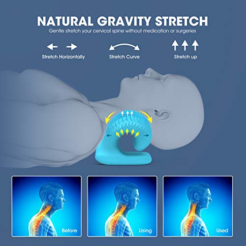 ZAMAT Neck and Shoulder Relaxer with Magnetic Therapy Pillowcase, Neck Stretcher Chiropractic Pillows for Pain Relief, Cervical Traction Device for Relieve TMJ Headache Muscle Tension Spine Alignment - color: Blue