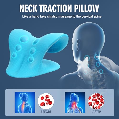 Neck Stretcher for Pain Relief, Neck and Shoulder Relaxer Cervical Traction Device Pillow for Muscle Relax and TMJ Pain Relief (Blue) - color: Blue