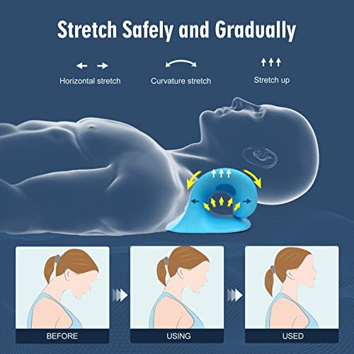 Neck Stretcher for Pain Relief, Neck and Shoulder Relaxer Cervical Traction Device Pillow for Muscle Relax and TMJ Pain Relief (Blue) - color: Blue