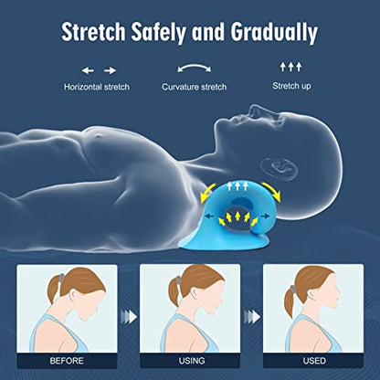 Neck Stretcher for Pain Relief, Neck and Shoulder Relaxer Cervical Traction Device Pillow for Muscle Relax and TMJ Pain Relief (Blue) - color: Blue