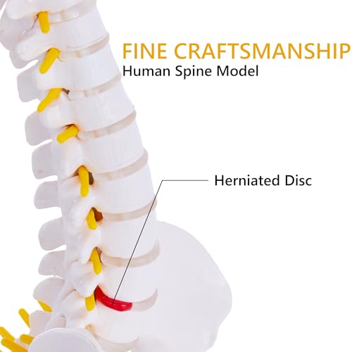 Mini Spine Anatomy Model - 15.5’’ Miniature Human Spine Model with All Nerves for Medical Learning - for Instruction Teaching, Study and Display