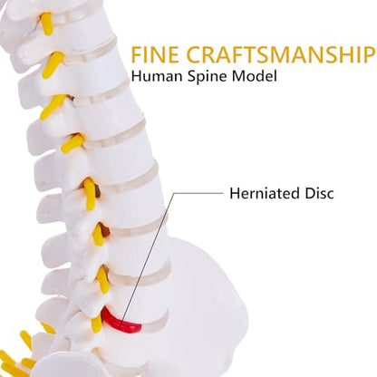 Mini Spine Anatomy Model - 15.5’’ Miniature Human Spine Model with All Nerves for Medical Learning - for Instruction Teaching, Study and Display