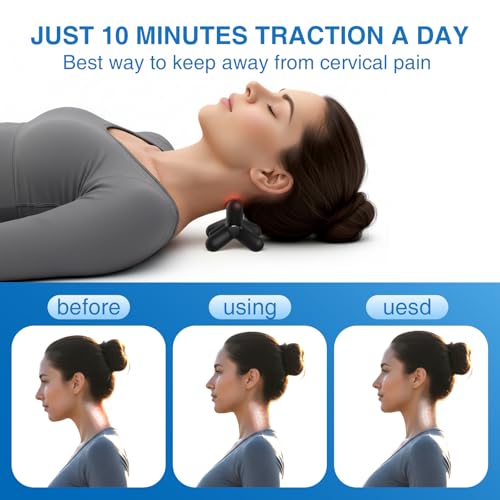 Occipital Release Tool, Release Tool for Neck for Headache Relief, Deep Nerve Release Tool with Acupressure Design Targeting Hard-to-Reach Muscles, Gift for Women & Men - color: Black