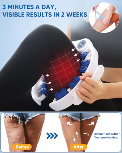 ONUEMP Cellulite Massage Tool Lymphatic Drainage Cellulite Remover for Legs - color: Blue