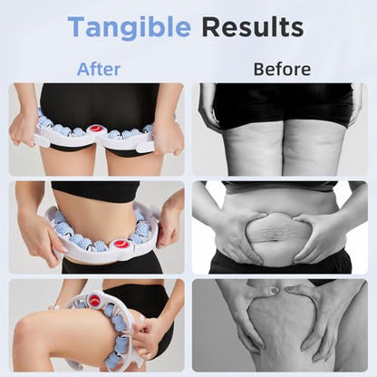 Cellulite Massage Tool - Lymphatic Drainage Massager - Muscle Roller, Deep Fascia Massage, Dimpled Skin Removal, Legs/Thighs/Buttocks, Anti-Cellulite Roller, Smooth Skin (14 Wheel - Blue) - color: White Blue