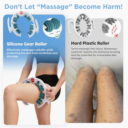 Cellulite Massage Tool - Lymphatic Drainage Massager - Muscle Roller, Deep Fascia Massage, Dimpled Skin Removal, Legs/Thighs/Buttocks, Anti-Cellulite Roller, Smooth Skin (14 Wheel - Green) - color: White Green