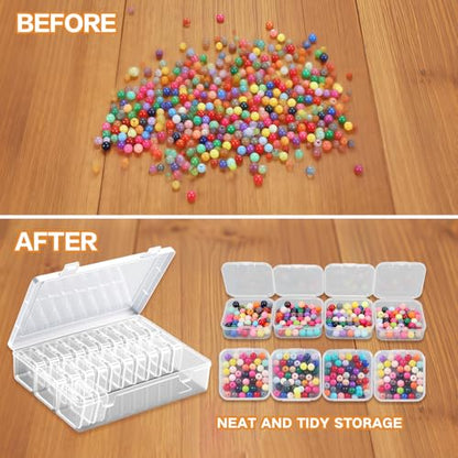 31 Clear Bead Storage Boxes with Hinged Lids | Ideal for Beads, Diamonds and Small Parts; Stackable Design for Easy Access; Snap-On Lids Keep Items Dust-Free & Organized