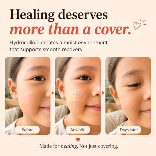 MoistureBand, Fast Healing Hydrocolloid Bandages for Kids, Waterproof & Gentle on Skin (Adventure Collection, 35 Count)