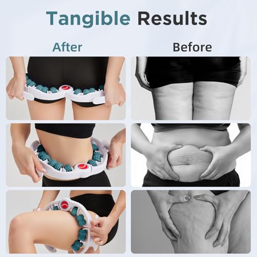 Cellulite Massage Tool - Lymphatic Drainage Massager - Muscle Roller, Deep Fascia Massage, Dimpled Skin Removal, Legs/Thighs/Buttocks, Anti-Cellulite Roller, Smooth Skin (14 Wheel - Green) - color: White Green