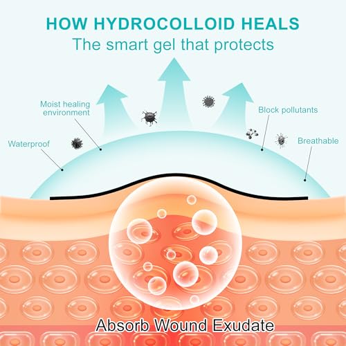 Hydrocolloid Roll for Wound Care, Medical-Grade Hydrocolloid Bandages with Self-Adhesive, Cut-to-Size Patch Bandages, Ultra Absorbent, Waterproof, First Aid Kit Essential (2in*4.8ft)